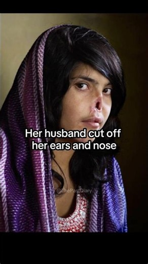 Afghan Teen Who Survived After Husband Remove Her Nose and Ears #afghanistan #womensrights #taliban