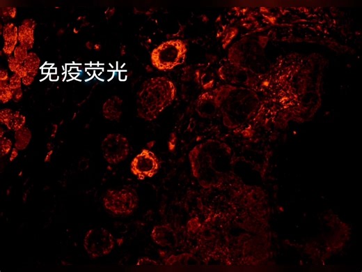 免疫荧光，IF，荧光实验，DAPI 目的染色 Merge，GFP，FITC，共定位，荧光单标，荧光双标，多标，荧光定量分析，ROS荧光，tune l荧光等