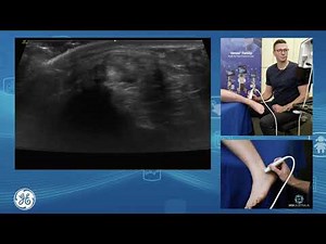Lateral Ligament Assessment for POCUS clinicians