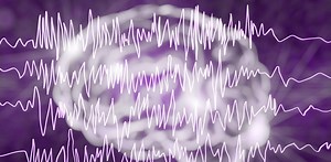Silent, subtle and unseen: How seizures happen and why they’re hard to diagnose