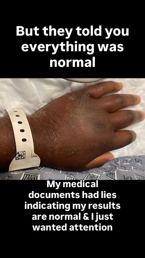 CaShawn Sims | Rapper | CPT Celebrity Trainer | STROKE SURVIVOR | My medical documents lied indicating I was completely normal to cover up for their nurses mistakes as they seccually a$$aulted me and gave... | Instagram