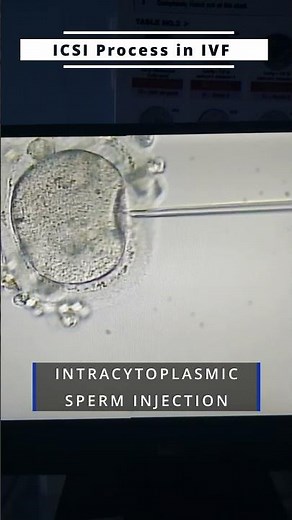 ICSI process in IVF ( intracytoplasmic sperm injection ) #ivf #icsi #fertilitytreatment #ivfprocess