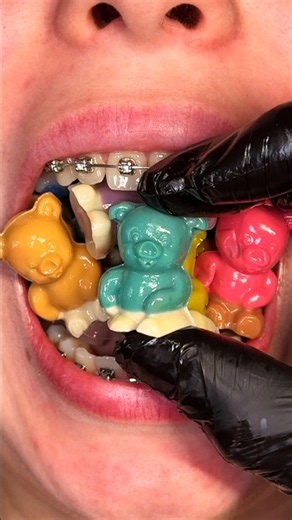 CLEANING BRACES FROM GUMMI BEARS #asmr