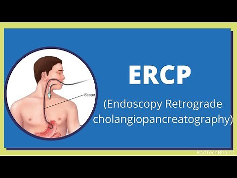 Endoscopic retrograde cholangiopancreatography (ERCP)