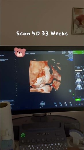 SCAN 5D