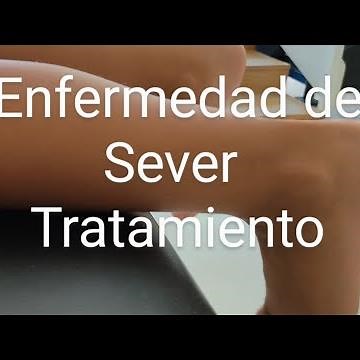 Enfermedad Sever : tratamiento