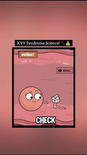 The Genetic Mutation and Cell Division Glitch Behind XYY Syndrome! 🔬🧬 #halthvideo
