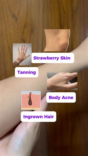 Shani Dhariwal on Instagram: "This works like crazy🤯 Products Used: @myplixlife Jamun 2% Salicylic Acid Body Wash Dry exfoliator How to use✨ Start by dry brushing your body in upward strokes, moving toward your head, before taking a bath. After that, focus on your concerned areas and use a this Body Wash to gently exfoliate the dead skin cells loosened by dry brushing, and rinse it off thoroughly. Finally, moisturize your body well to lock in hydration. (Bodywash, bodycare, exfoliate, exfoliati