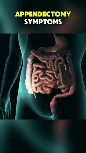 Understanding Appendectomy Symptoms and Recovery