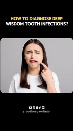 Deep wisdom tooth infection is silent until it becomes dangerous. Early treatment makes a difference