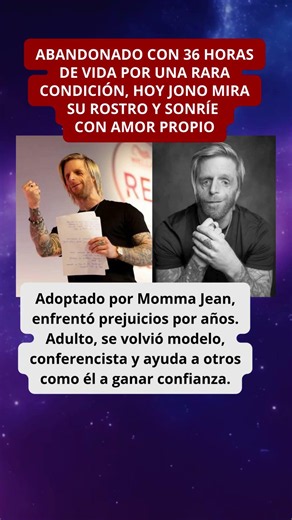 ABANDONADO CON 36 HORAS DE VIDA HOY INSPIRA A MILES DE PERSONAS