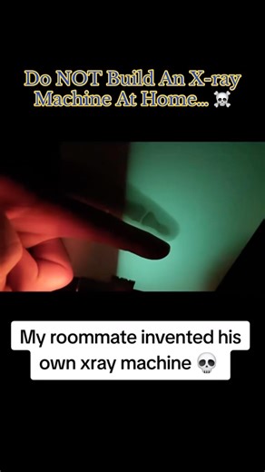 Do NOT Build An X-ray Machine At Home… ☠️ #interesting