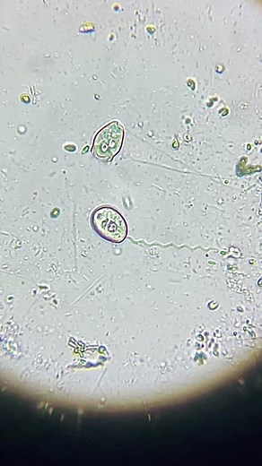 Protozoa Found in Rainwater: Microscopic Wonders