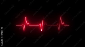 ECG cardiogram oscilloscope. Heartbeat line showing.Heart beat cardiogram.