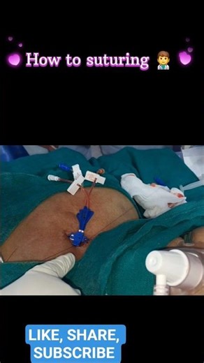 How 🤔 to suturing 👨‍⚕️ ll #nursing #medicalshorts"