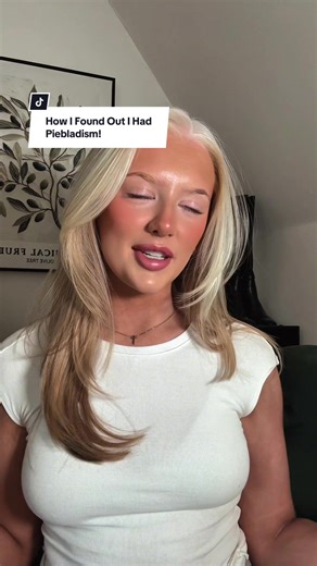 Discovering Piebaldism: A Family Journey