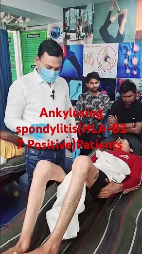 ankylosing spondylitis (HLA-B27 Positive)Patient