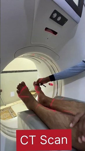 Ct Scan of Leg 🦵 & Thigh