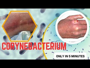 corynebacterium microbiology lecture ||corynebacterium ||Easy Microbiology