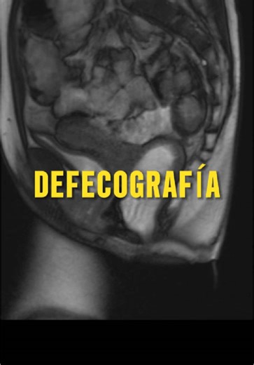 Estudio de Radiología: Proctografía Defecativa