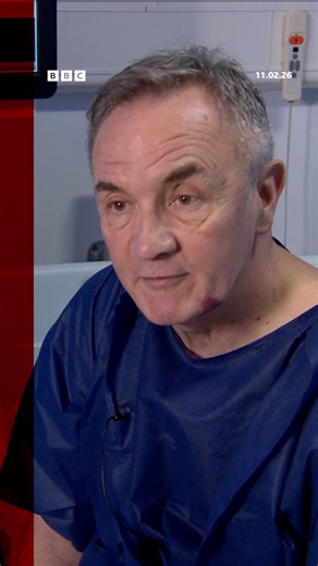 "Patients are soon back to a normal life after treatment." Michael has been living with atrial fibrillation (AF), a common heart rhythm problem and is hoping new cutting edge treatment will dramatically improve his quality of life. Read more here: https://bbc.in/3ZuNXyV | BBC News NI