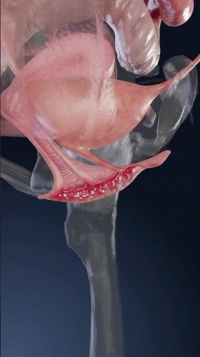 Was ist eine Vulvitis und wie beeinflusst sie die Gesundheit von Frauen? Erklärt in 3D