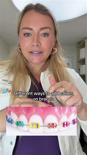 Normal o ties vs figure 8 ties #braces #bracescolors