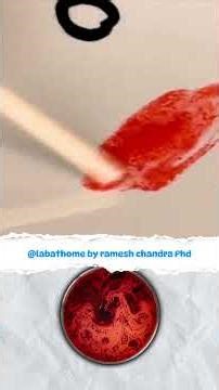 How Pathology Labs Test Your Blood Group