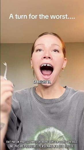 💀 When your jaw gets stuck open…