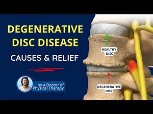 Degenerative Disc Disease, Back Pain Causes, Symptoms & Relief