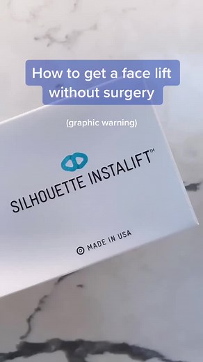 non-surgical face lift aka #threadlift 🤩 #fyp #facelift #thread #facial #threading #cosmetic #surgery #nonsurgical #nonsurgicalfacelift #foryou