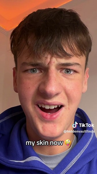 LED Light Mask Reviews: What You Need to Know