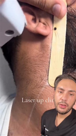 12K views · 18 reactions | When laser hair removal goes wrong  Not shaving properly can ruin your results… and your skin. #lasertreatment #laserhairremoval #laserhairremovaltreatment #lasergonewrong #laserburn #medicalaesthetician #lasertechnician | Justin Spracklin | Facebook