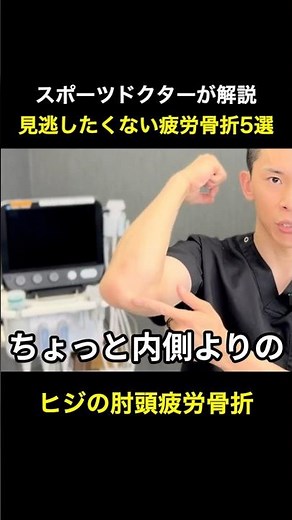 ヒジの肘頭疲労骨折 スポーツドクターが解説 #疲労骨折 #スポーツ復帰 #アスリート#整形外科 #医療解説