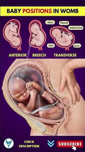 Baby Positions in Womb During Pregnancy Explained | Types of Baby Positions Every Mom Should Know