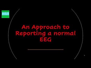 An Approach to Reporting a Normal EEG