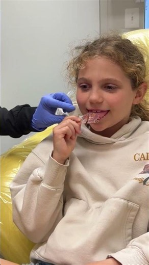 How to Turn a Removable Palatal Expander: Step-by-Step Guide for Parents