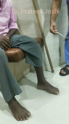 Upper Motor Neuron Lesion Clinical Signs | Babinski Reflex | Exaggerated Knee Jerk Patellar Reflex