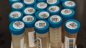 Wastewater helps scientists track infectious diseases