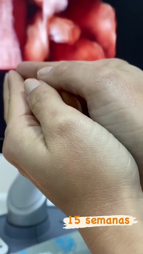 Understanding Fetal Development at 15 Weeks