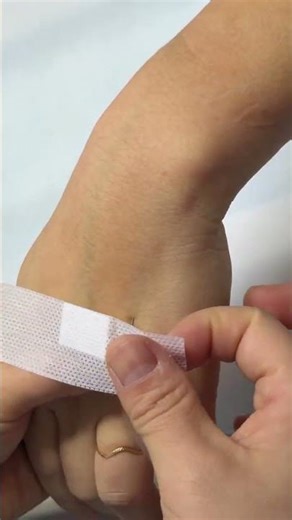 ​IV Drip Insertion (Butterfly Needle)