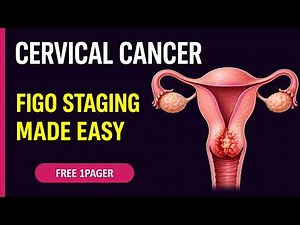 Cervical Cancer: HPV, FIGO Staging & Treatment Explained