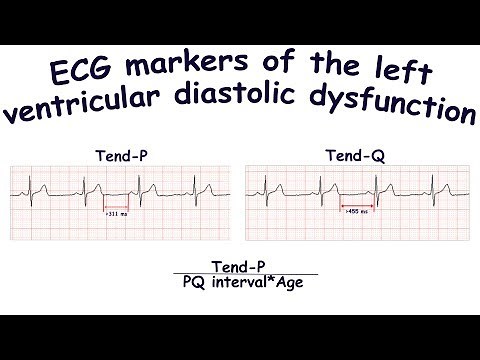 ECG markers of the left ventricular diastolic dysfunction: Tend-P, Tend-Q