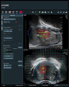 Advanced Technology - Texas Radiotherapy