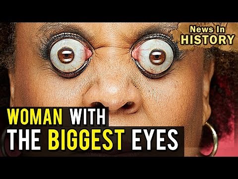 The Biggest Eyes in the World: Kim Goodman - News In History