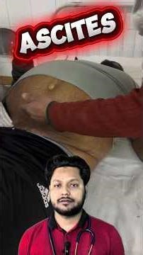 Ascites: Causes, Symptoms, and Treatments