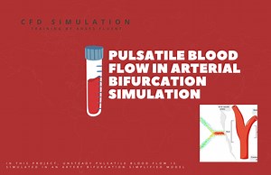 Pulsatile Blood Flow in Arterial Bifurcation Simulation, ANSYS Fluent Training - MR CFD