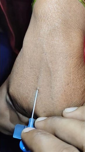 Iv cannulation insertion technique | iv cannulation technique in hindi | injection kaise lagate hain