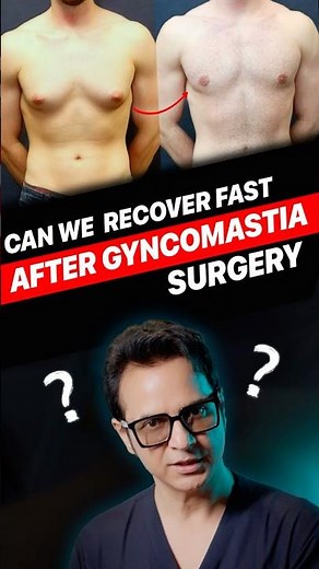 How Fast Can You Recover After Gynecomastia Surgery?