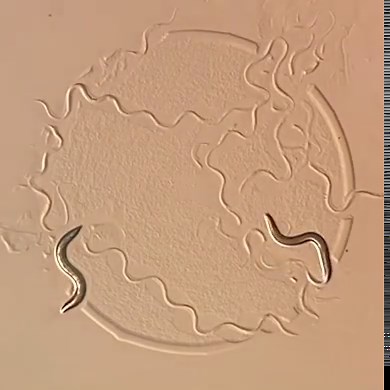 C. elegans study finds mRNA balance in cells influences lifespan